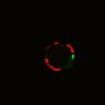 Thumbnail for Figure6H_Fucci2a_EGFRi_7