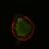 Thumbnail for Figure6H_Fucci2a_EGFRivsErbB2i_4