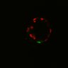 Thumbnail for dataset Figure6H_Fucci2a_MEKi_4