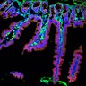 Thumbnail for dataset Figure7BC_20170607_C_EGFR_Ecad_2_CHIR99021
