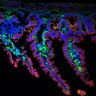 Thumbnail for dataset Figure7BC_20170607_NC_EGFR_Ecad_1_control