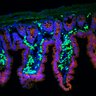 Thumbnail for dataset Figure7DE_EGFR-E-Cadherin_normal