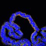 Thumbnail for dataset Figure7FG_EGFRvsErbB2i_adenoma_1