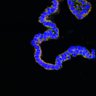 Thumbnail for dataset Figure7FG_EGFRvsErbB2i_adenoma_2