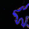 Thumbnail for dataset Figure7FG_EGFRvsErbB2i_normal_2