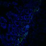 Thumbnail for dataset Figure7HI_20170524_Edu_CHIRvsErlotinib_2