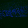 Thumbnail for dataset Figure7HI_20170524_Edu_CHIRvsErlotinib_4