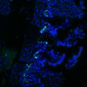 Thumbnail for dataset Figure7HI_20170524_Edu_CHIRvsErlotinib_6
