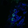 Thumbnail for dataset Figure7HI_20170524_Edu_CHIRvsErlotinib_7