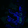 Thumbnail for dataset Figure7HI_20170524_Edu_CHIRvsErlotinib_8