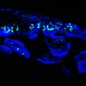 Thumbnail for dataset Figure7HI_20170602_Erlotinib_1-1