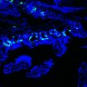 Thumbnail for dataset Figure7HI_20170602_Erlotinib_1-2