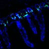 Thumbnail for dataset Figure7HI_20170602_Erlotinib_1-4