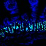 Thumbnail for dataset Figure7HI_20170602_Erlotinib_2-4
