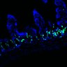 Thumbnail for dataset Figure7HI_20170602_Erlotinib_3-3