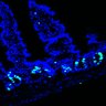 Thumbnail for dataset Figure7HI_20170602_Erlotinib_3-4