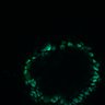 Thumbnail for dataset Figure8H_20180105_adenoma_control_post1