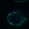 Thumbnail for dataset Figure8H_20180105_adenoma_control_post2