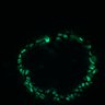 Thumbnail for dataset Figure8H_20180105_adenoma_control_pre1