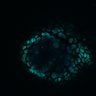 Thumbnail for Figure8H_20180105_adenoma_control_pre2