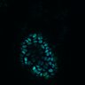 Thumbnail for dataset Figure8H_20180105_adenoma_Lrig3_post1