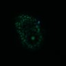 Thumbnail for dataset Figure8H_20180105_adenoma_Lrig3_post2