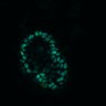 Thumbnail for Figure8H_20180105_adenoma_Lrig3_pre1