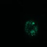 Thumbnail for dataset Figure8H_20180105_adenoma_shEGFL6_pre2