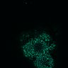 Thumbnail for dataset Figure8H_20180105_adenoma_shFLNA_post1