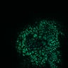 Thumbnail for dataset Figure8H_20180105_adenoma_shFLNA_post2