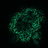 Thumbnail for dataset Figure8H_20180105_adenoma_shFLNA_pre2