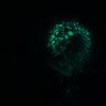 Thumbnail for dataset Figure8H_20180105_adenoma_shTroy_pre1