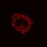 Thumbnail for dataset Figure8I_20180103_adenoma_control