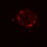Thumbnail for dataset Figure8I_20180103_adenoma_shEGFL6