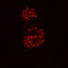 Thumbnail for dataset Figure8I_20180103_adenoma_shFLNA