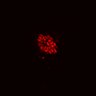 Thumbnail for dataset Figure8I_20180103_adenoma_shTROY