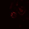 Thumbnail for dataset SuppFig4B_20171022_EGFRi_Post1