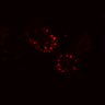 Thumbnail for dataset SuppFig4B_20171022_EGFRi_Post4