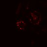 Thumbnail for dataset SuppFig4B_20171022_EGFRi_Pre1