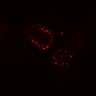 Thumbnail for SuppFig4B_20171022_EGFRi_Pre4