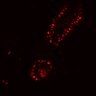 Thumbnail for dataset SuppFig4B_20171022_ErbB2i_Post2
