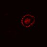Thumbnail for dataset SuppFig4E_EGFRi-ErbB2i_post2