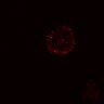Thumbnail for dataset SuppFig5B_Wnt_EGFRi-ErbB2i_post2