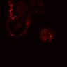 Thumbnail for dataset SuppFig5E_bcat_EGFRi_post3