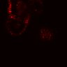 Thumbnail for dataset SuppFig5E_bcat_EGFRi_pre3