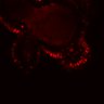 Thumbnail for dataset SuppFig5E_bcat_EGFRi-ErbB2i_post1