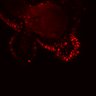 Thumbnail for dataset SuppFig5E_bcat_EGFRi-ErbB2i_pre1