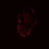 Thumbnail for dataset SuppFig5E_bcat_EGFRi-ErbB2i_pre3