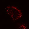Thumbnail for dataset SuppFig5E_bcat_ErbB2i_post1