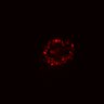 Thumbnail for dataset SuppFig5E_bcat_ErbB2i_post2